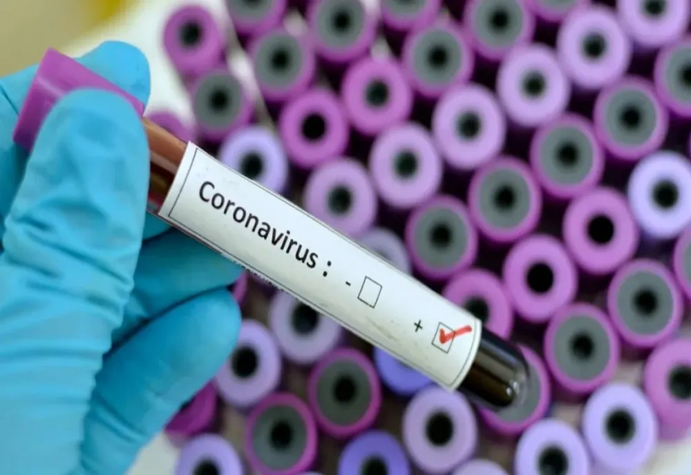 Crește, din nou, bilanțul cazurilor noi de coronavirus. 250 de cazuri noi. 8 în Dâmbovița (total 372)