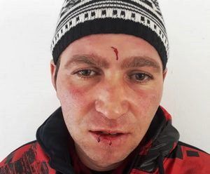 Iubire cu năbădăi. Un bărbat și-a acuzat iubita că l-a altoit