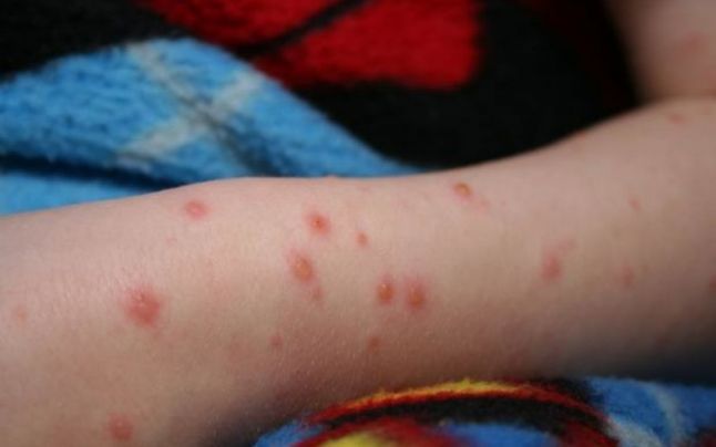 Șantierul magistralei de gaze BRUA, care ar trebui să treacă și prin Dâmbovița, blocat de descoperiri arheologice