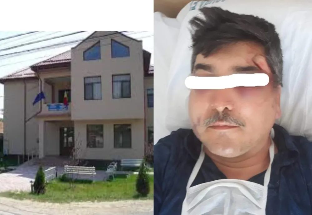 Scandal monstruos la Nucet.Doi bărbați răniți, în urma unei altercații stradale. Primăria din localitate intervine