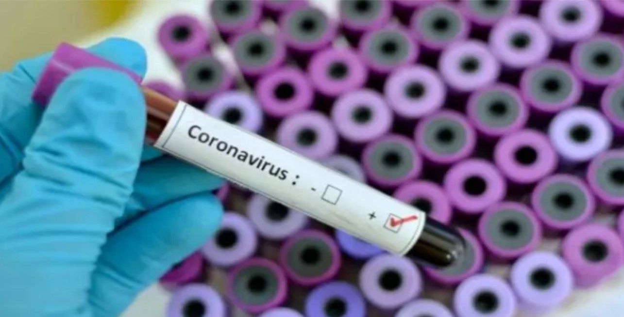 coronavirus 3
