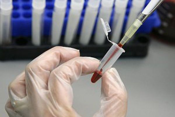 A ajuns cu mașina în șanț și s-a ales cu dosar penal, după ce a refuzat recoltarea de probe biologice,