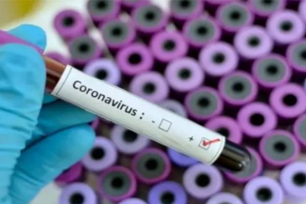 Coronavirus-România. Informare MAI-29 februarie (ora 11.00)