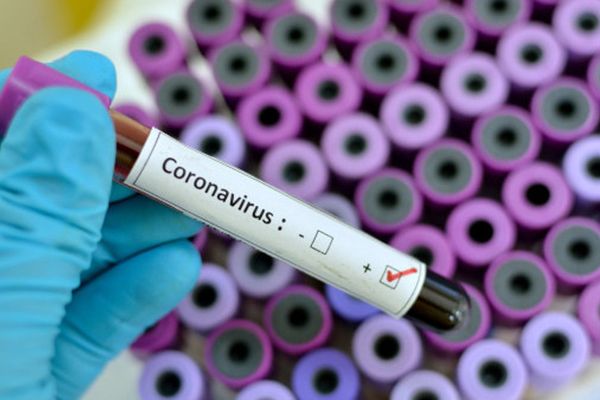 Alertă! Epidemia de coronavirus face ravagii. Sfaturi utile pentru românii din Italia dar și din țară