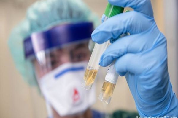 Autoritățile au raportat încă trei decese cauzate de infecția cu coronavirus. Toate cele trei victime sunt din județul Ialomita.