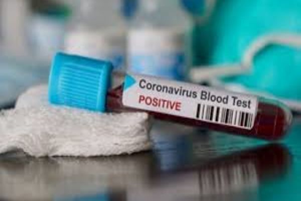 Update| Au fost confirmate și apoi infirmate primele cazuri de coronavirus în Dâmbovița. Este vorba de 2 persoane carantinate în județ