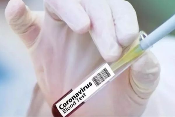 Bilanțul deceselor în România, actualizat: 205 persoane infectate cu coronavirus au murit. Între victime, o femeie de 38 de ani