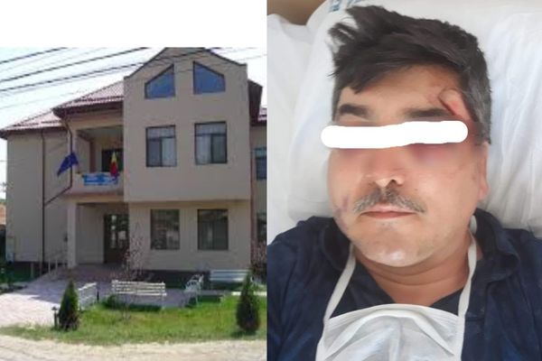 Scandal monstruos la Nucet. Doi bărbați răniți, în urma unei altercații stradale. Primăria din localitate intervine