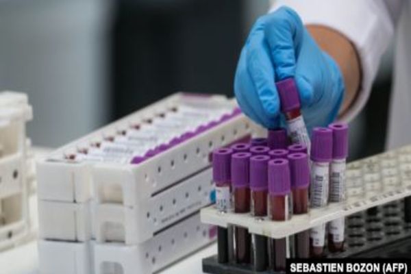 ALARMANT: 416 de noi cazuri de infectare cu COVID-19 în România