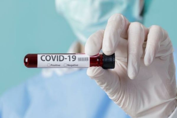 COVID -19. 2.121 de noi cazuri, în țară. În ce județe sunt cei mai mulți infectați