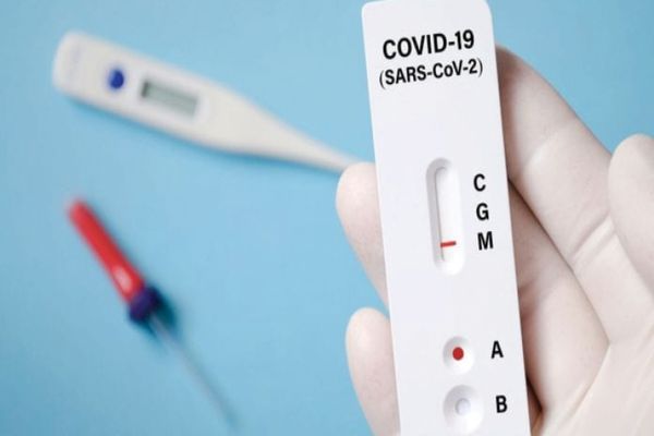 Testarea rapidă în farmacii pentru depistarea COVID-19, aprobată de Ministerul Sănătății 