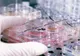 Coronavirus. Primul deces în afara Chinei. Numărul deceselor crește spectaculos
