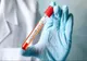 Update| Încă două  cazuri de CORONAVIRUS confirmate, în România! Un minor din Timiș și un bărbat (71 de ani) din Suceava