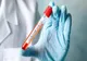 Doar 2 cazuri noi de coronavirus, în Dâmbovița, în ultimele 24 de ore (total 282 cazuri). La nivel național 191 cazuri noi