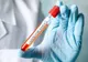 Încă 145 de cazuri noi de coronavirus, la nivel național. Trei sunt în Dâmbovița (total 321 de cazuri)